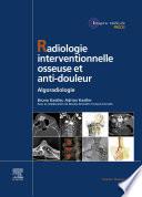Radiologie Interventionnelle osseuse et anti-douleur