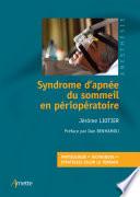 Syndrome d'apnée du sommeil en périopératoire