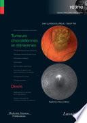 Tumeurs choroïdiennes et rétiniennes / Divers (volume 8 - coffret rétine)