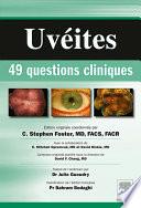 Uvéites : 49 questions cliniques
